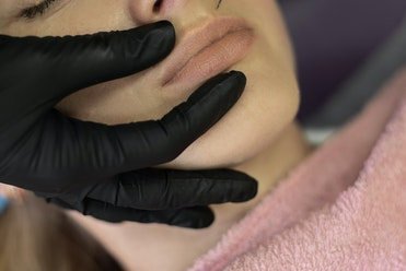 Microneedling for Scars and Wrinkles: Clearfield’s Transformations