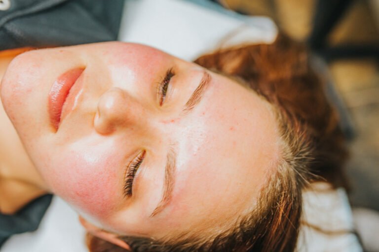 Clearfield’s Microneedling Aftercare: Tips for Beautiful Skin