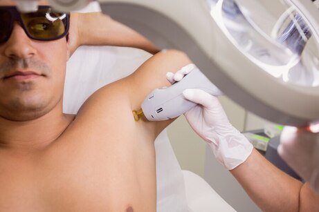 Laser Hair Removal for Men: Benefits and Considerations